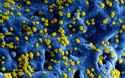 Perils of Pareidolia and AI: Can AI find disease clusters?